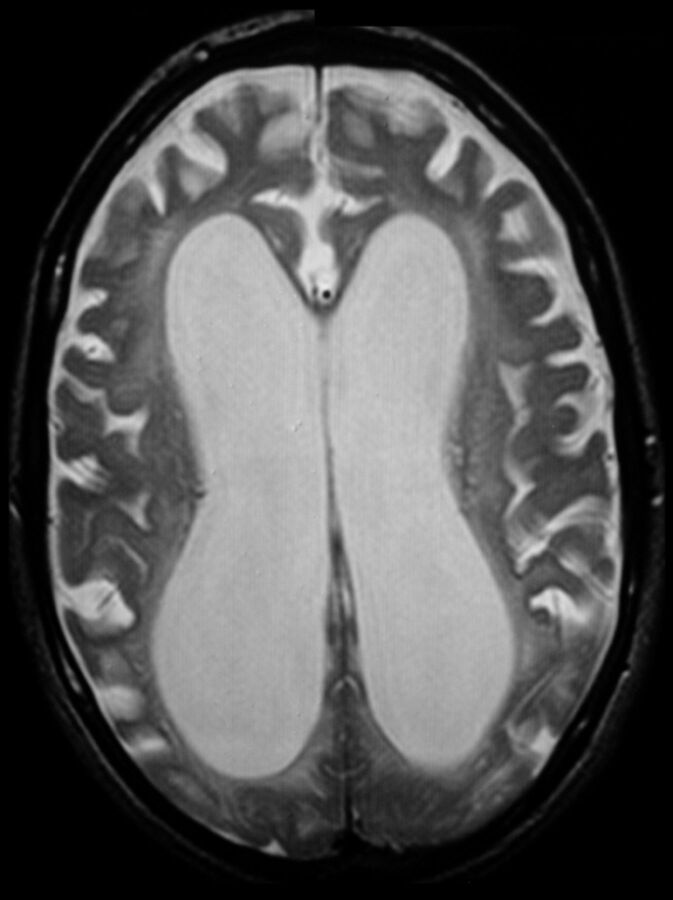 Fig 2.