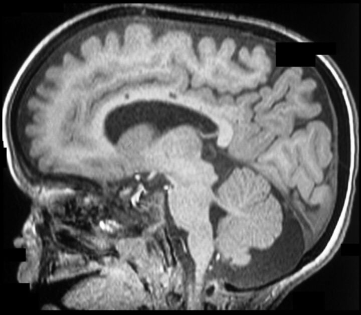 Fig 5.