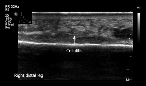 Figure 29