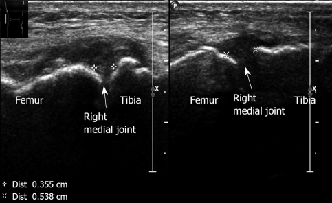 Figure 21