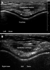 Figure 24