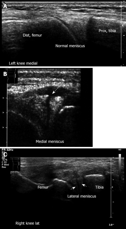 Figure 18