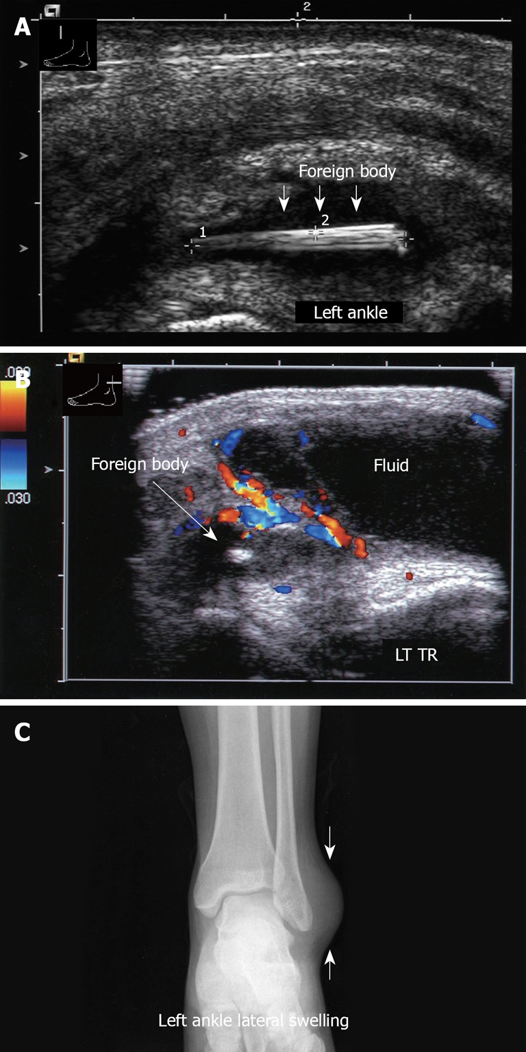 Figure 30