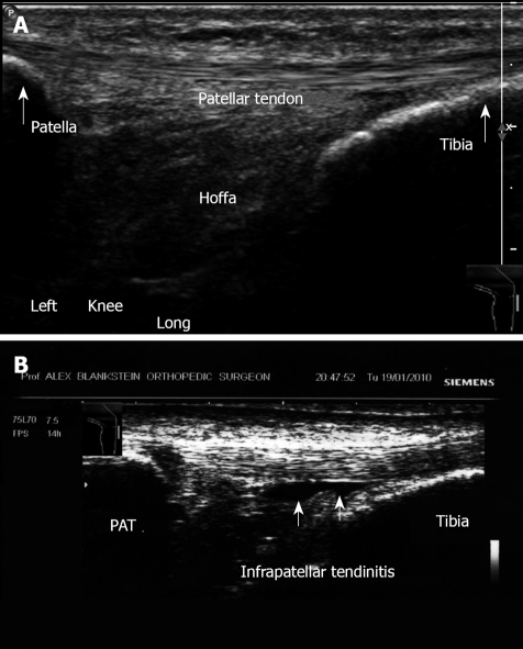 Figure 23