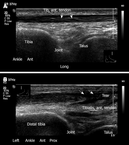 Figure 27