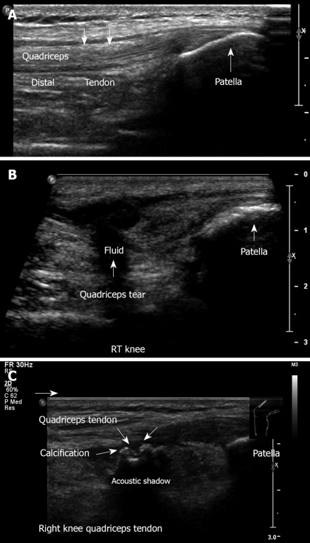 Figure 19