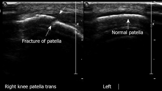 Figure 25