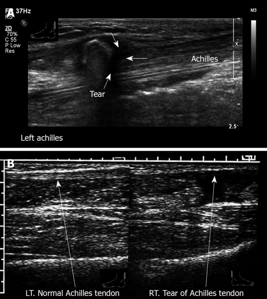 Figure 26