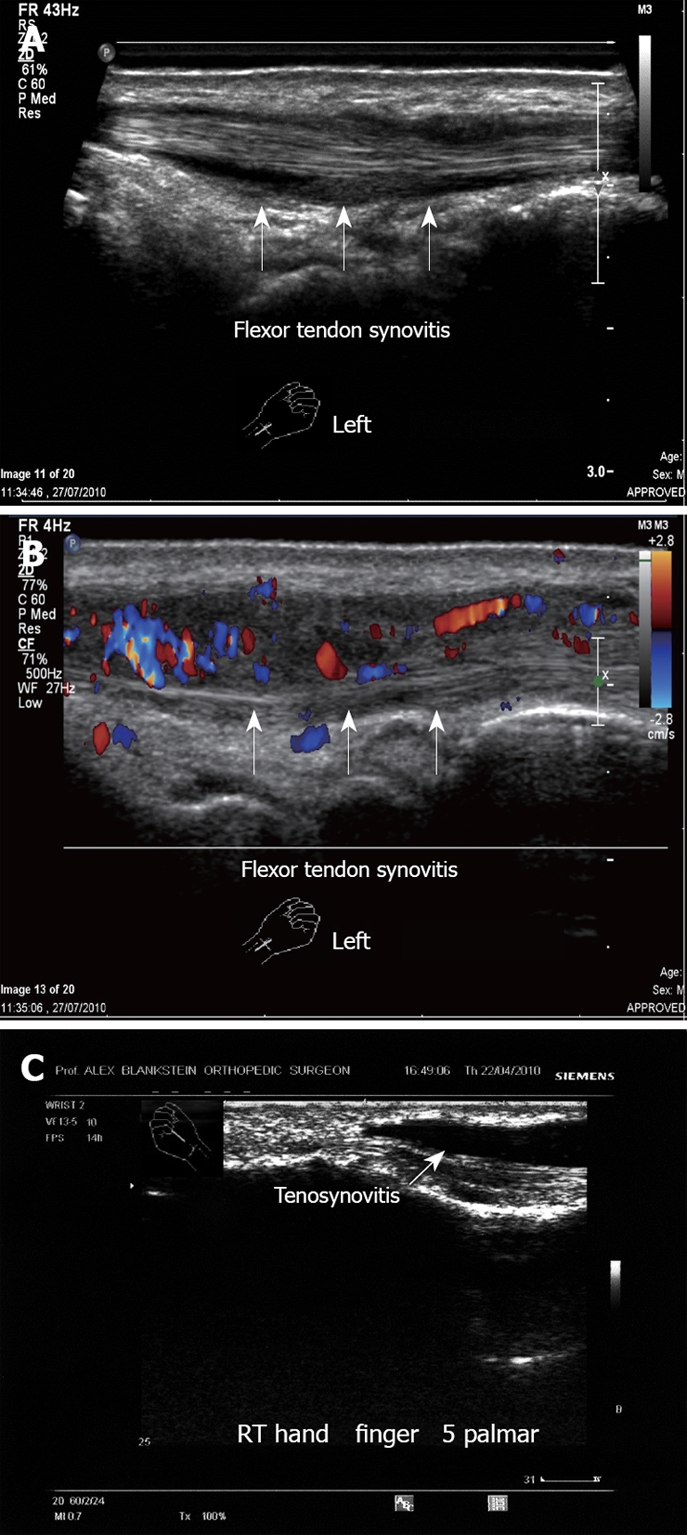 Figure 15