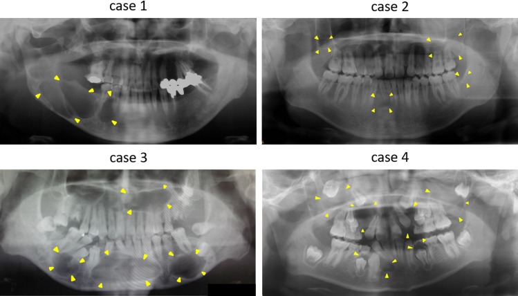 Fig 2