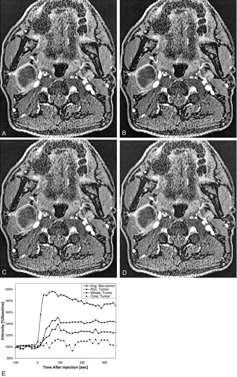 Fig 4.