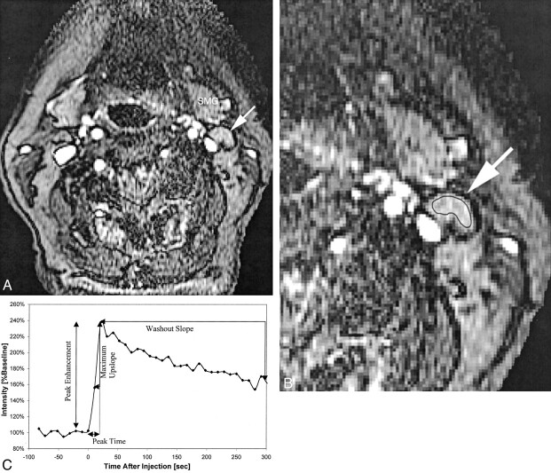 Fig 2.