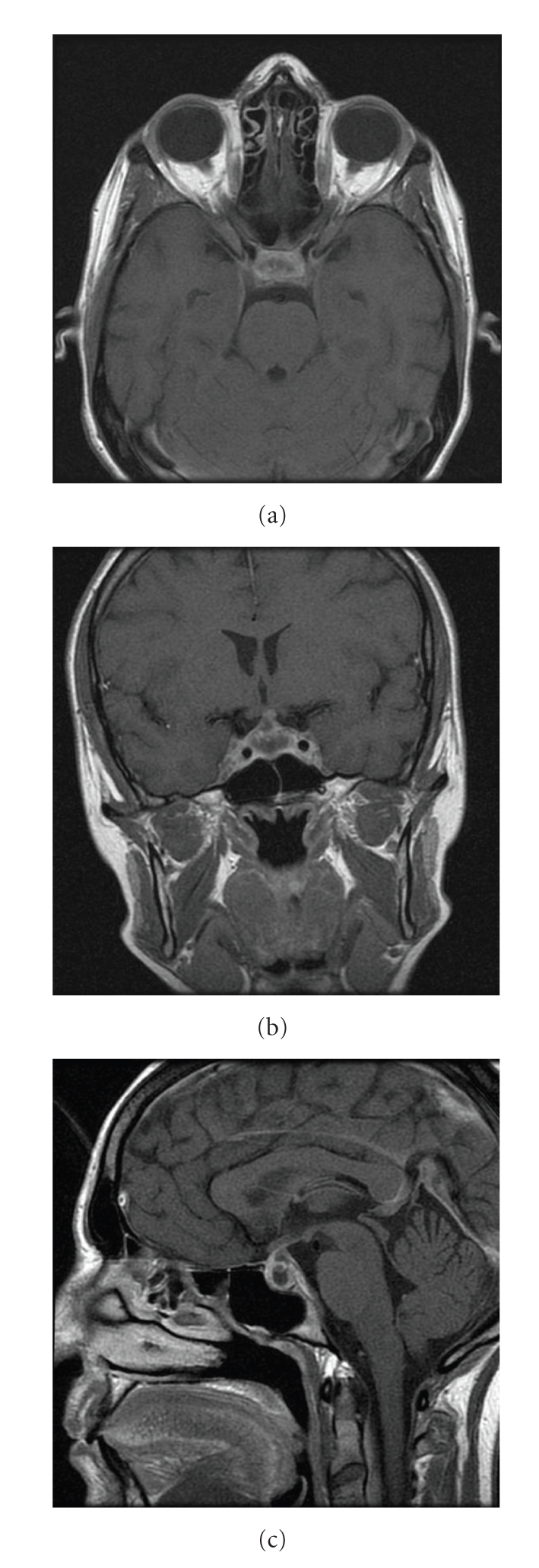 Figure 1