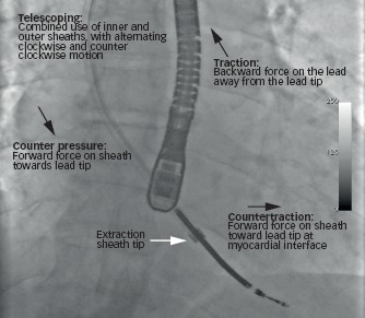 Figure 2: