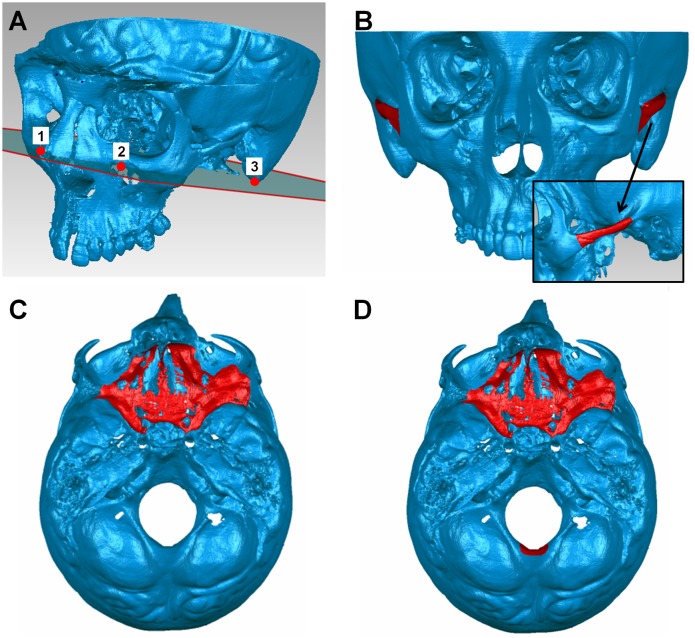 Fig 1