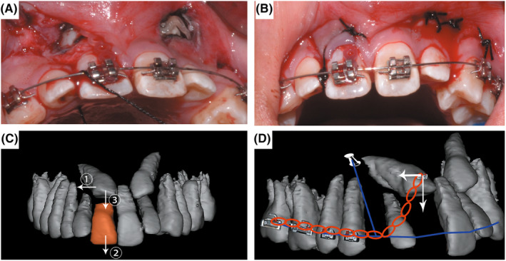 FIGURE 3