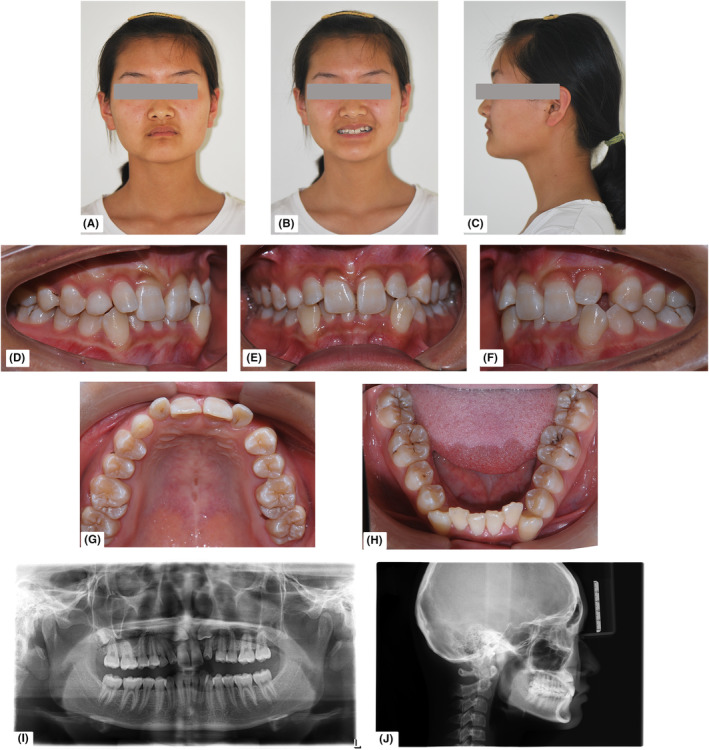 FIGURE 1