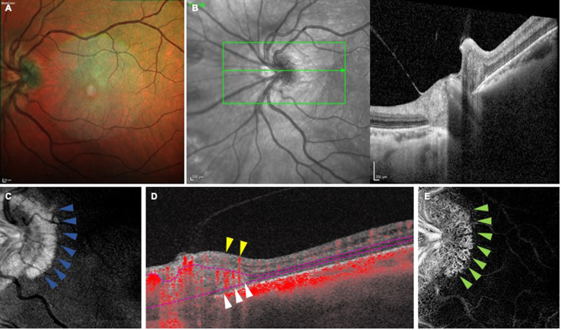 Fig. 1