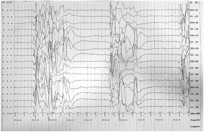 FIGURE 2