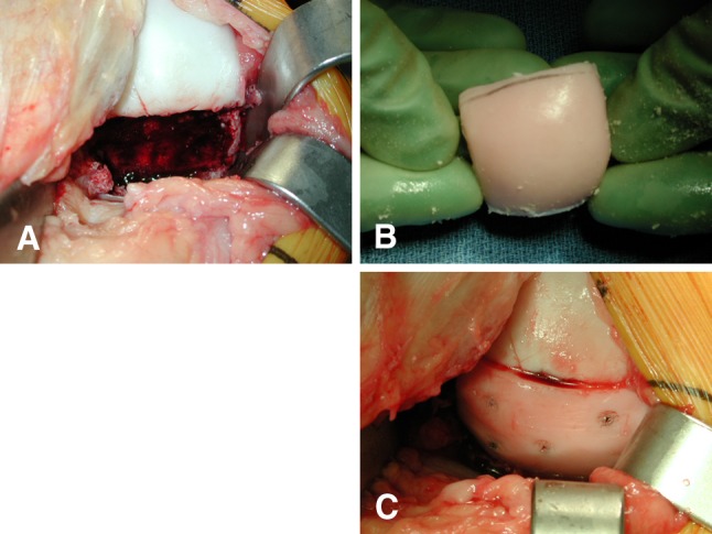 Fig. 1A–C