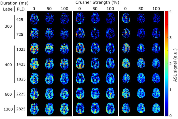 FIGURE 3