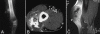 Figure 9 (A-C)