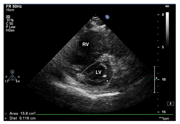 Figure 5