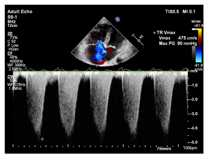 Figure 12