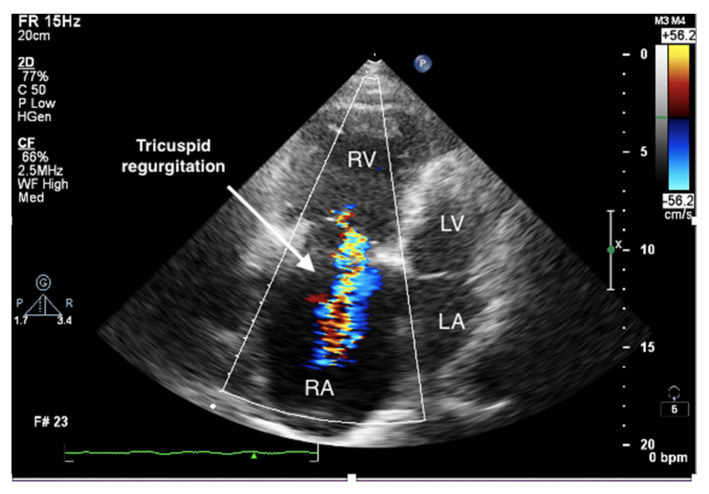 Figure 4