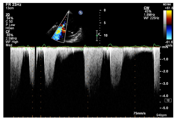 Figure 13