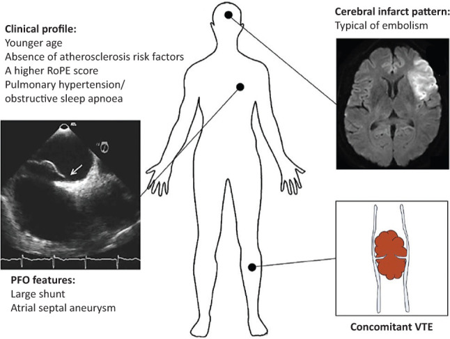 Fig 2.