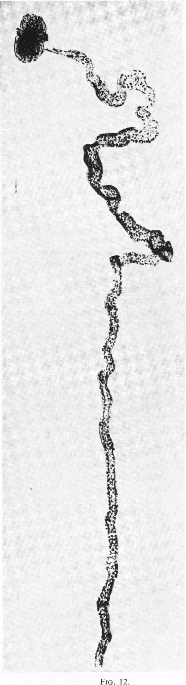 Fig. 12