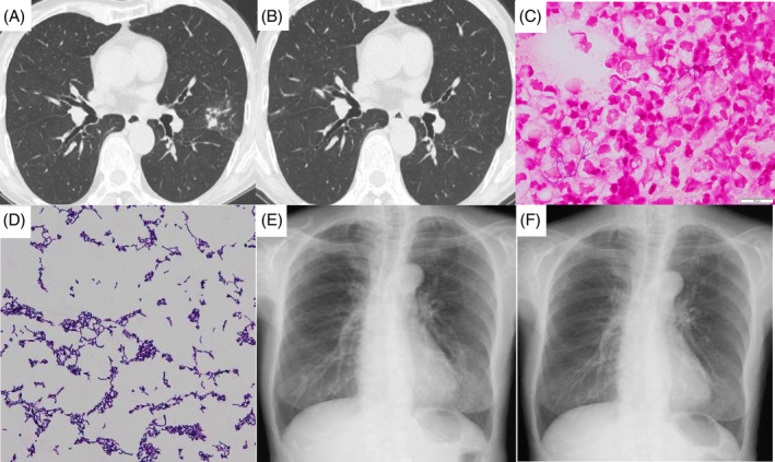 FIGURE 1