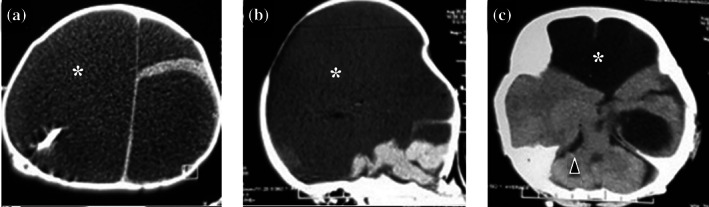 FIGURE 3