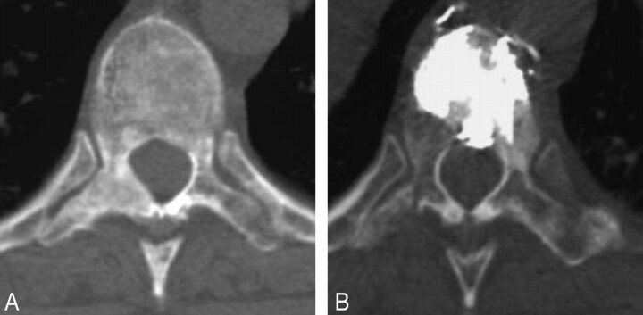 Fig 2.