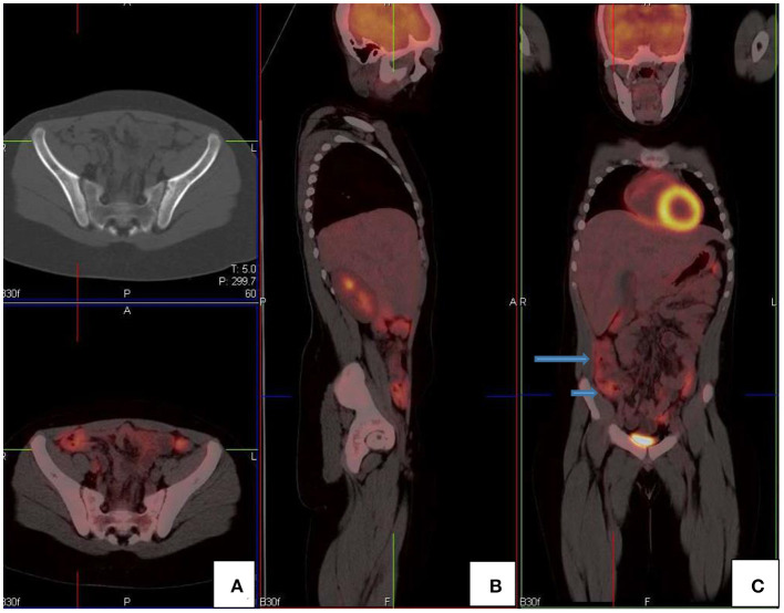 Figure 11