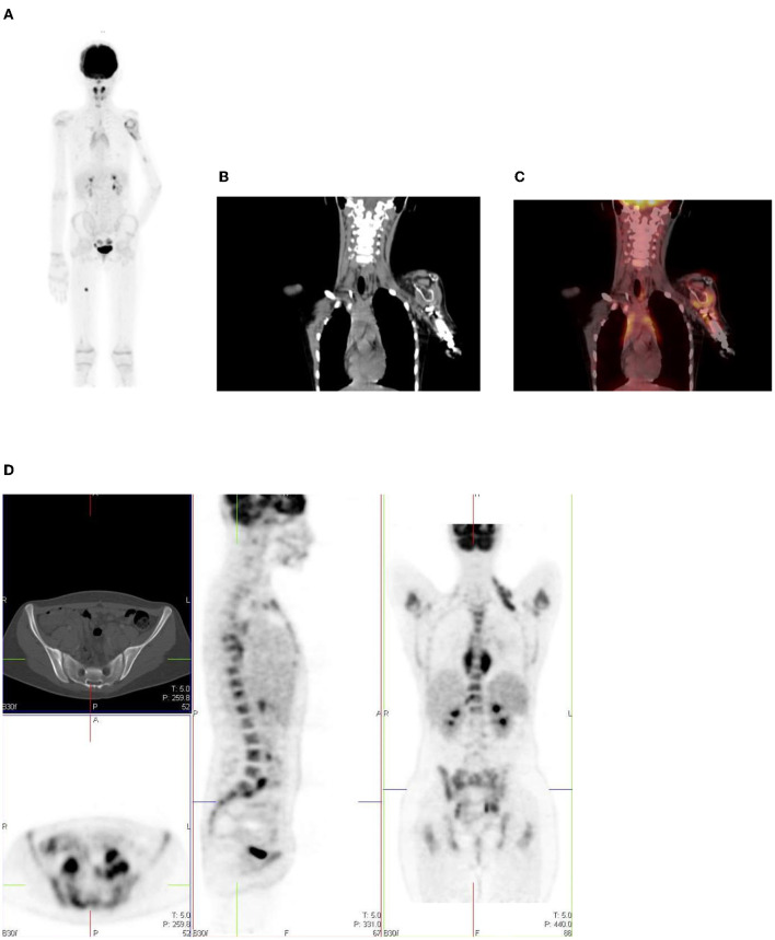 Figure 17