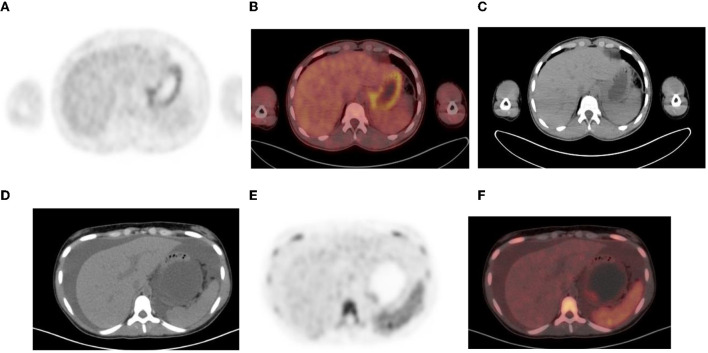 Figure 12