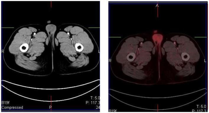 Figure 15