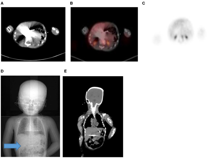 Figure 18