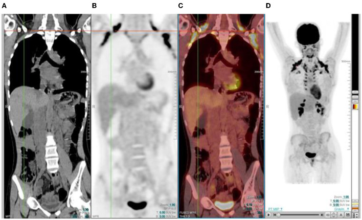 Figure 16