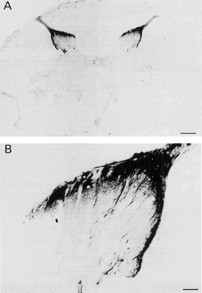 Fig. 17