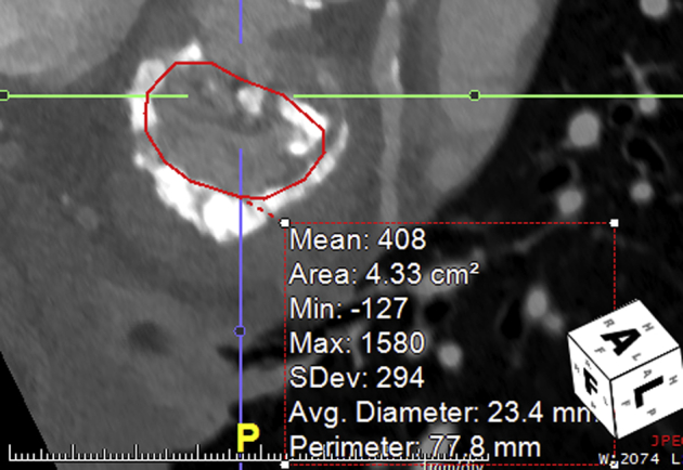 Figure 1