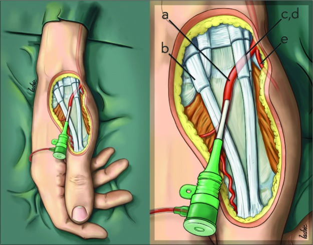 Figure 5: