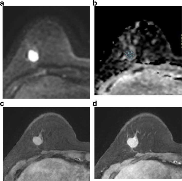 Fig. 2