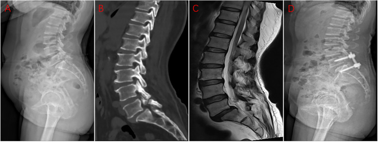 Fig. 1