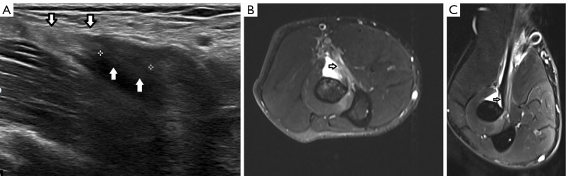 Figure 17