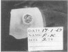 82
