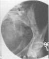 85