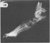 83